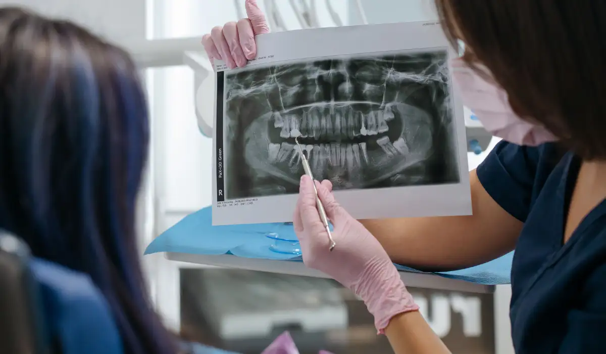 Wisdom Tooth Extraction