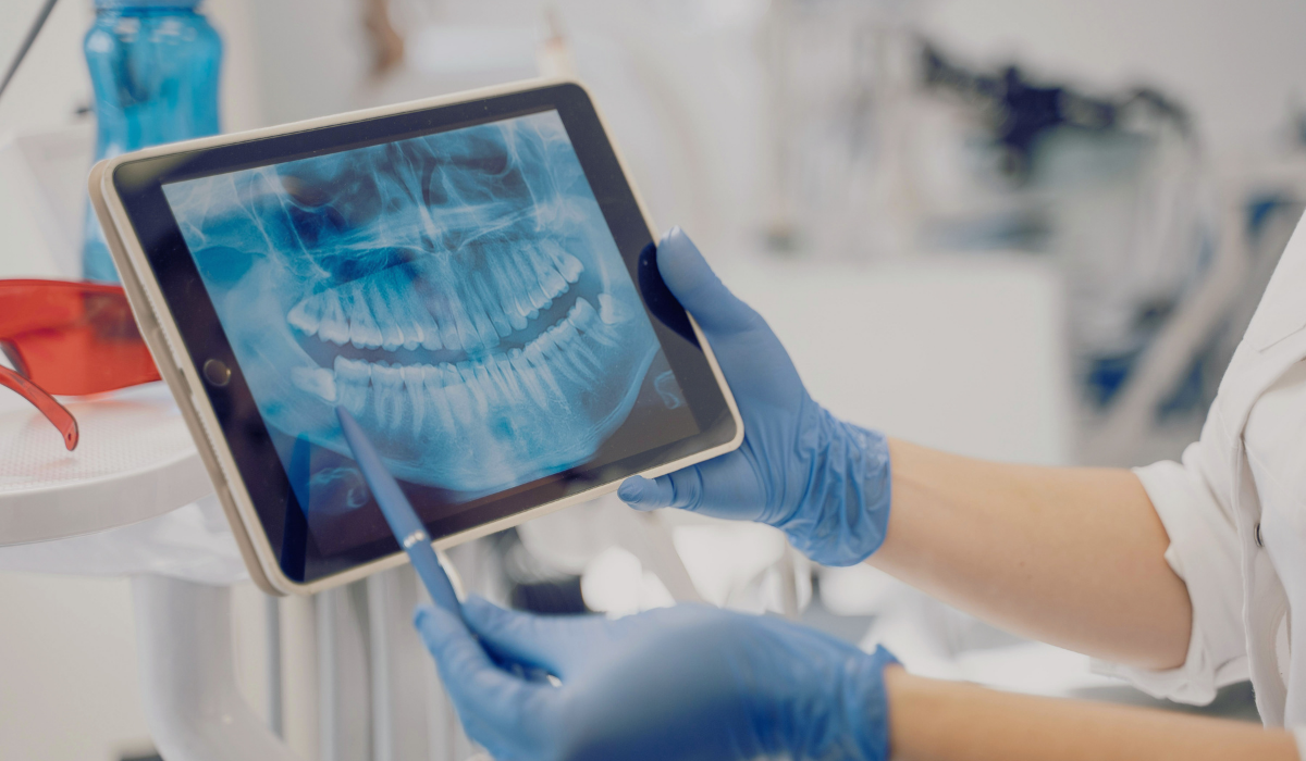 how long does pericoronitis last